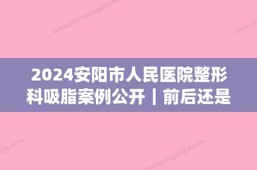 2024安阳市人民医院整形科吸脂案例公开｜前后还是一个人吗？(安阳 整形)