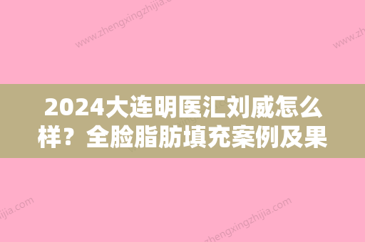 2024大连明医汇刘威怎么样？全脸脂肪填充案例及果图展示