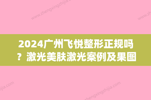 2024广州飞悦整形正规吗？激光美肤激光案例及果图展示(广州飞悦妍美医疗整形医院)