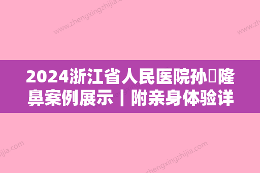 2024浙江省人民医院孙燚隆鼻案例展示｜附亲身体验详细过程图