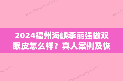 2024福州海峡李丽强做双眼皮怎么样？真人案例及恢复图分享(福州海峡整形割双眼皮怎么样)