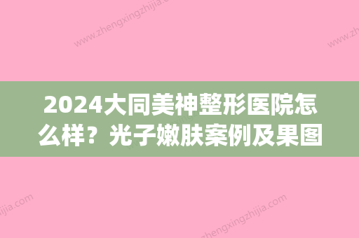 2024大同美神整形医院怎么样？光子嫩肤案例及果图公布(大同美神整形医院好不好)