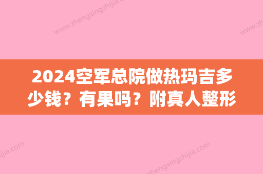 2024空军总院做热玛吉多少钱？有果吗？附真人整形案例~(空军总医院做热玛吉多少钱)