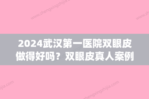 2024武汉第一医院双眼皮做得好吗？双眼皮真人案例及费用分享~(武汉做双眼皮价格)