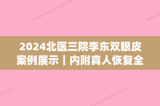 2024北医三院李东双眼皮案例展示｜内附真人恢复全过程(北医三院双眼皮李东价格)