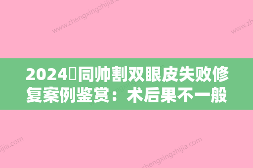 2024佀同帅割双眼皮失败修复案例鉴赏：术后果不一般，超迷人！