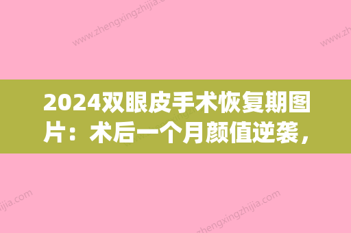 2024双眼皮手术恢复期图片：术后一个月颜值逆袭，实在太美！(双眼皮恢复过程图3个月)