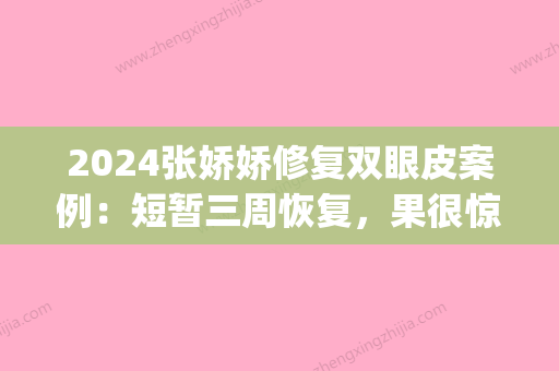 2024张娇娇修复双眼皮案例：短暂三周恢复，果很惊人！(双眼皮修复失败案例)