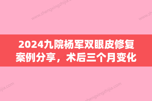 2024九院杨军双眼皮修复案例分享，术后三个月变化及恢复情况对比~(上海九院杨军全切双眼皮修复手术)