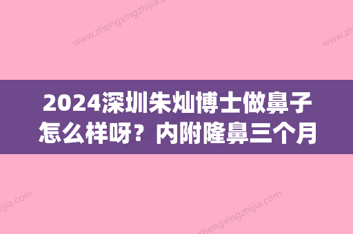 2024深圳朱灿博士做鼻子怎么样呀？内附隆鼻三个月后恢复对比案例~(朱灿做鼻子审美怎么样)