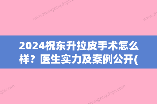 2024祝东升拉皮手术怎么样？医生实力及案例公开(祝东升拉皮手术能维持几年)