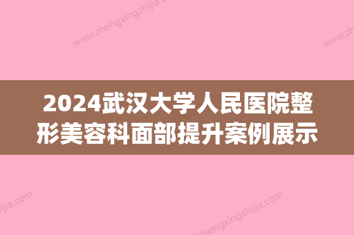 2024武汉大学人民医院整形美容科面部提升案例展示｜内附体验感悟(武汉大学整形外科)