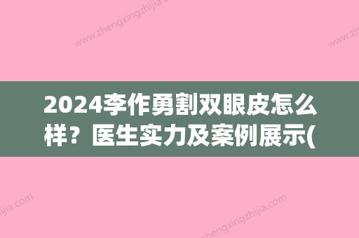 2024李作勇割双眼皮怎么样？医生实力及案例展示(双眼皮修复李勇)