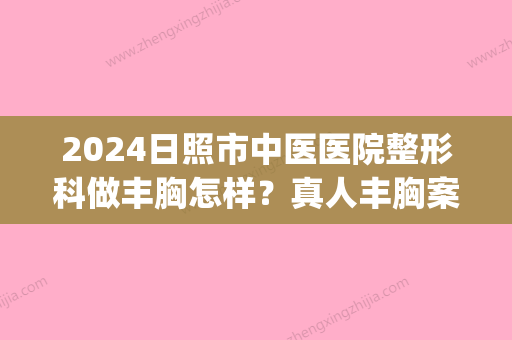 2024日照市中医医院整形科做丰胸怎样？真人丰胸案例及感悟分享(日照市医美美容医院)