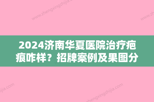 2024济南华夏医院治疗疤痕咋样？招牌案例及果图分享