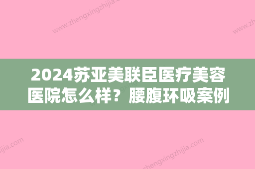 2024苏亚美联臣医疗美容医院怎么样？腰腹环吸案例及果图展示