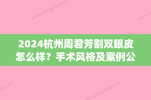 2024杭州周君芳割双眼皮怎么样？手术风格及案例公布(周慧芳双眼皮新案例)