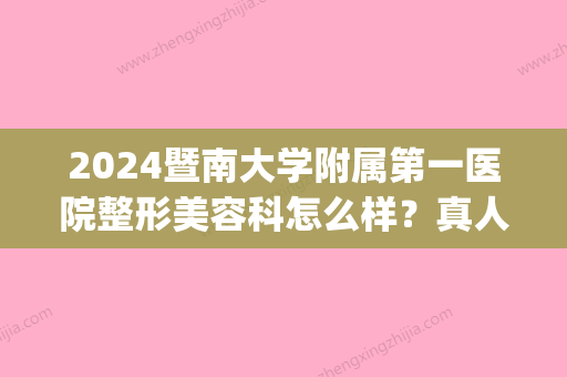 2024暨南大学附属第一医院整形美容科怎么样？真人瘦脸除皱案例公布(暨南大学医院美容外科价格)