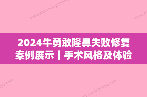 2024牛勇敢隆鼻失败修复案例展示｜手术风格及体验感悟一览(隆鼻成功案例)