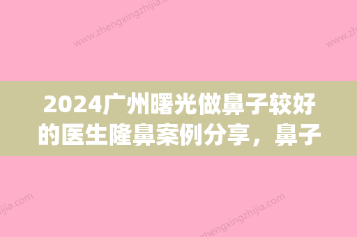 2024广州曙光做鼻子较好的医生隆鼻案例分享	，鼻子真的太自然了吧~(曙光哪个医生做鼻子好)