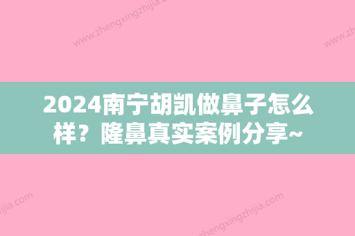 2024南宁胡凯做鼻子怎么样？隆鼻真实案例分享~