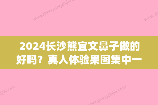 2024长沙熊宜文鼻子做的好吗？真人体验果图集中一览(熊宜文做鼻子怎么样)