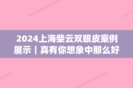 2024上海柴云双眼皮案例展示｜真有你想象中那么好？(柴云双眼皮修复)