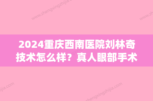 2024重庆西南医院刘林奇技术怎么样？真人眼部手术案例及果图展示(重庆西南整形医院刘林奇)