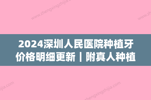 2024深圳人民医院种植牙价格明细更新｜附真人种植案例(深圳市第二人民医院种植牙)