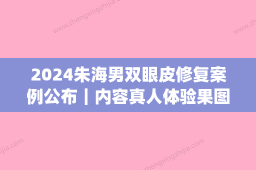 2024朱海男双眼皮修复案例公布｜内容真人体验果图(上海九院朱海男割双眼皮怎么样)