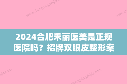 2024合肥禾丽医美是正规医院吗？招牌双眼皮整形案例展示(合肥禾丽医美是三甲医院吗)