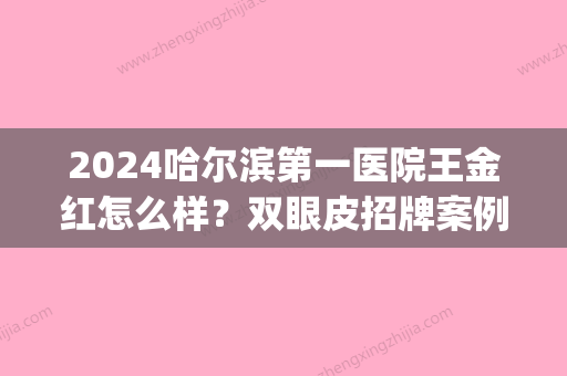 2024哈尔滨第一医院王金红怎么样？双眼皮招牌案例展示(哈尔滨王丽丹双眼皮案例)