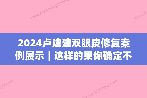 2024卢建建双眼皮修复案例展示｜这样的果你确定不心动？(卢建建 双眼皮)