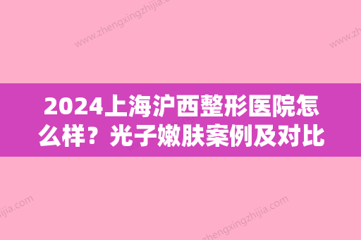 2024上海沪西整形医院怎么样？光子嫩肤案例及对比图分享