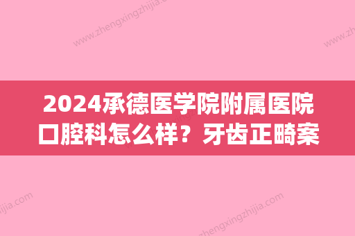 2024承德医学院附属医院口腔科怎么样？牙齿正畸案例全新一览(承德附属医院南院有没有口腔科吗)