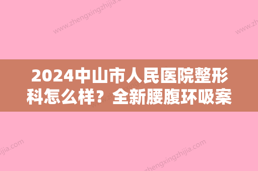 2024中山市人民医院整形科怎么样？全新腰腹环吸案例一览