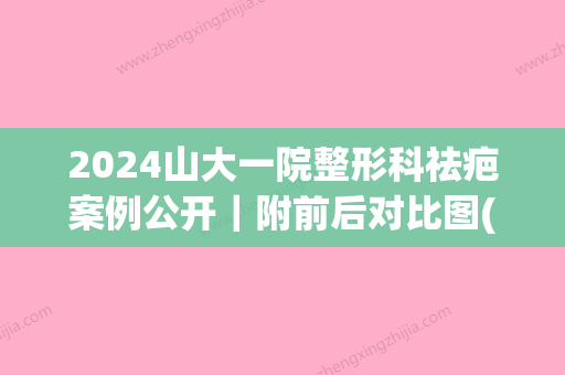 2024山大一院整形科祛疤案例公开｜附前后对比图(山大一院整形科哪个大夫好)