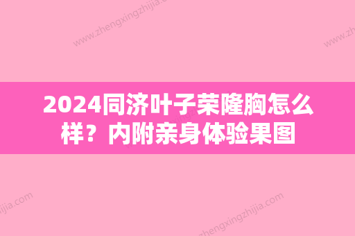 2024同济叶子荣隆胸怎么样？内附亲身体验果图