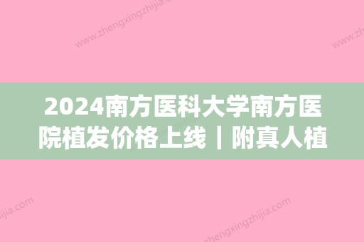 2024南方医科大学南方医院植发价格上线｜附真人植发案例(有在南方医院做过植发的吗)