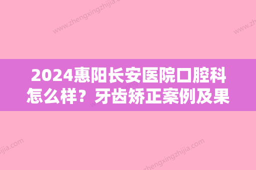 2024惠阳长安医院口腔科怎么样？牙齿矫正案例及果图展示