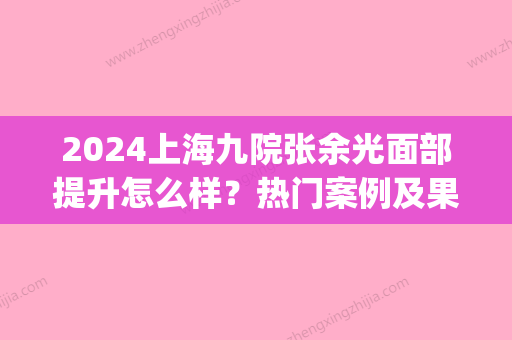 2024上海九院张余光面部提升怎么样？热门案例及果图公布(上海九院 张余光)