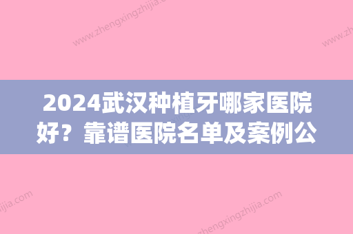 2024武汉种植牙哪家医院好？靠谱医院名单及案例公布(武汉种植牙排名)