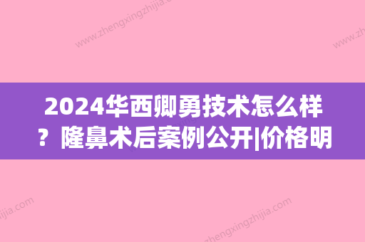 2024华西卿勇技术怎么样？隆鼻术后案例公开|价格明细表(华西医院卿勇做鼻子怎么样?)