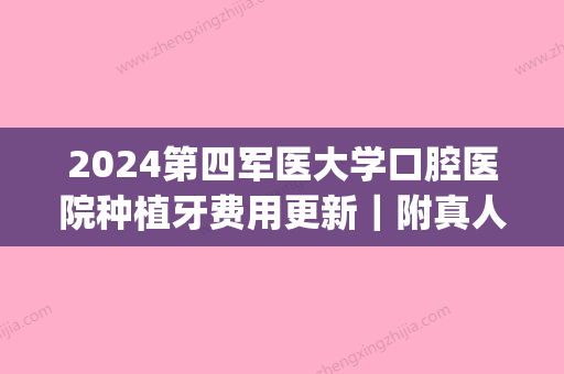 2024第四军医大学口腔医院种植牙费用更新｜附真人种植牙案例(四医大口腔科种植牙)