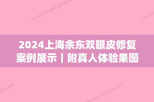 2024上海余东双眼皮修复案例展示｜附真人体验果图(上海余东双眼皮怎么样)