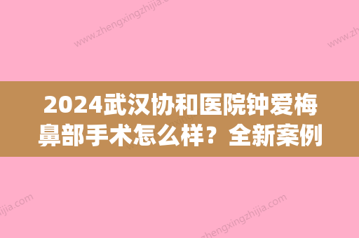 2024武汉协和医院钟爱梅鼻部手术怎么样？全新案例+收费标准公布(武汉协和整形钟爱梅)