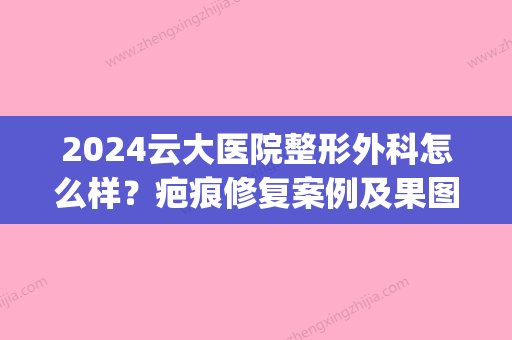 2024云大医院整形外科怎么样？疤痕修复案例及果图展示(云大医院祛疤怎么样)