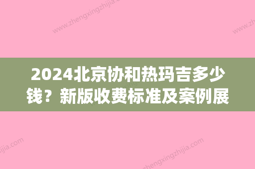 2024北京协和热玛吉多少钱？新版收费标准及案例展示(北京协和热玛吉价格)