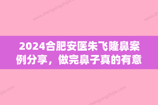 2024合肥安医朱飞隆鼻案例分享，做完鼻子真的有意想不到的变化(合肥朱飞割双眼皮)