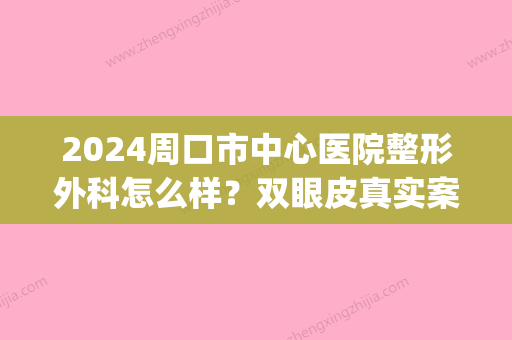 2024周口市中心医院整形外科怎么样？双眼皮真实案例分享|整形价格表